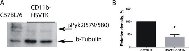 Phospho-PYK2 (Tyr579, Tyr580) Antibody in Western Blot (WB)