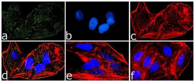 Phospho-PYK2 (Tyr579, Tyr580) Antibody