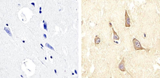 Phospho-PYK2 (Tyr579, Tyr580) Antibody in Immunohistochemistry (Paraffin) (IHC (P))