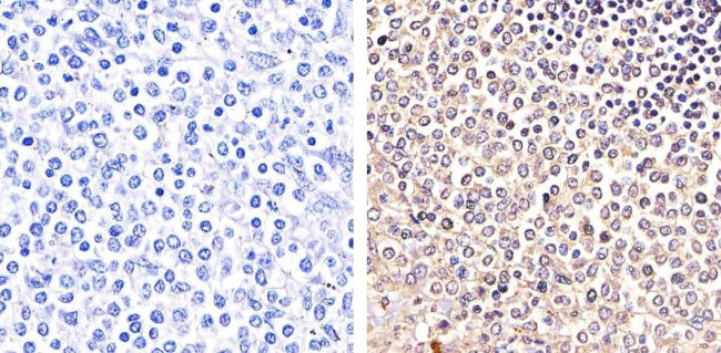 Phospho-PYK2 (Tyr579, Tyr580) Antibody in Immunohistochemistry (Paraffin) (IHC (P))