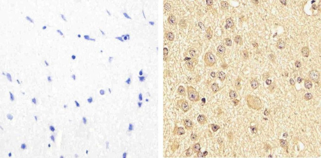 Phospho-PYK2 (Tyr579, Tyr580) Antibody in Immunohistochemistry (Paraffin) (IHC (P))