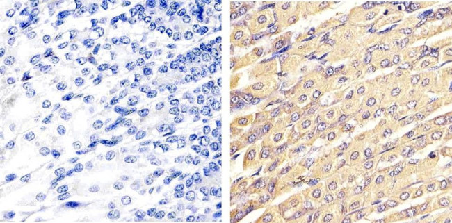 ERK1/ERK2 Antibody in Immunohistochemistry (Paraffin) (IHC (P))