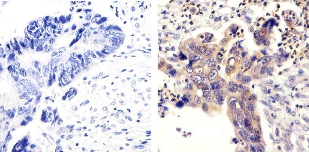 SRC Antibody in Immunohistochemistry (Paraffin) (IHC (P))