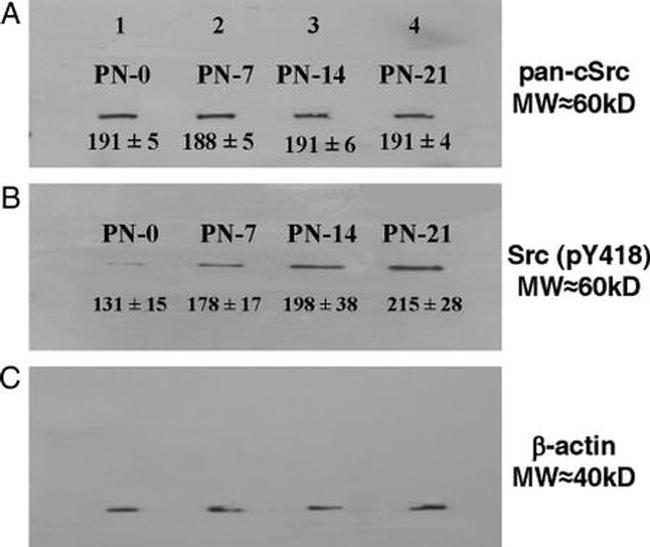 SRC Antibody in Western Blot, Immunoprecipitation (WB, IP)