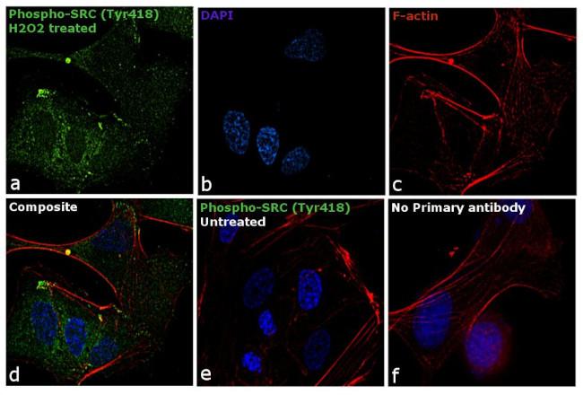 Phospho-SRC (Tyr419) Antibody in Immunocytochemistry (ICC/IF)