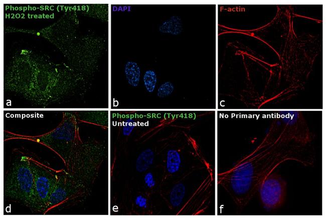 Phospho-SRC (Tyr419) Antibody