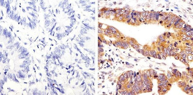 Phospho-SRC (Tyr419) Antibody in Immunohistochemistry (Paraffin) (IHC (P))