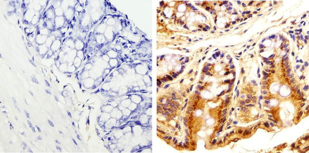 Phospho-SRC (Tyr529) Antibody in Immunohistochemistry (Paraffin) (IHC (P))