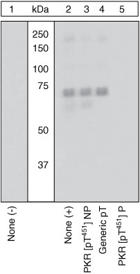 Phospho-PKR (Thr451) Antibody in Western Blot (WB)