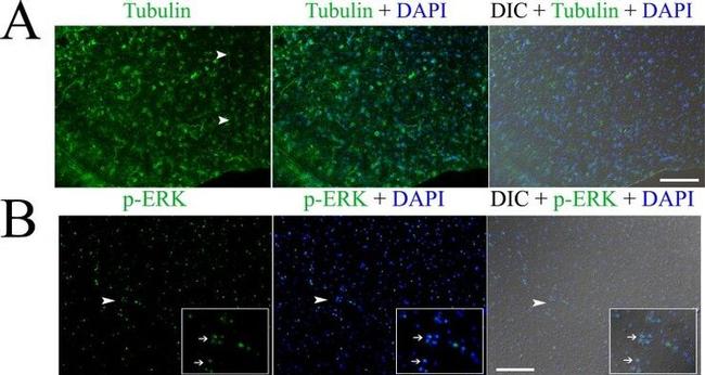 Phospho-ERK1/ERK2 (Thr185, Tyr187) Antibody in Immunocytochemistry (ICC/IF)