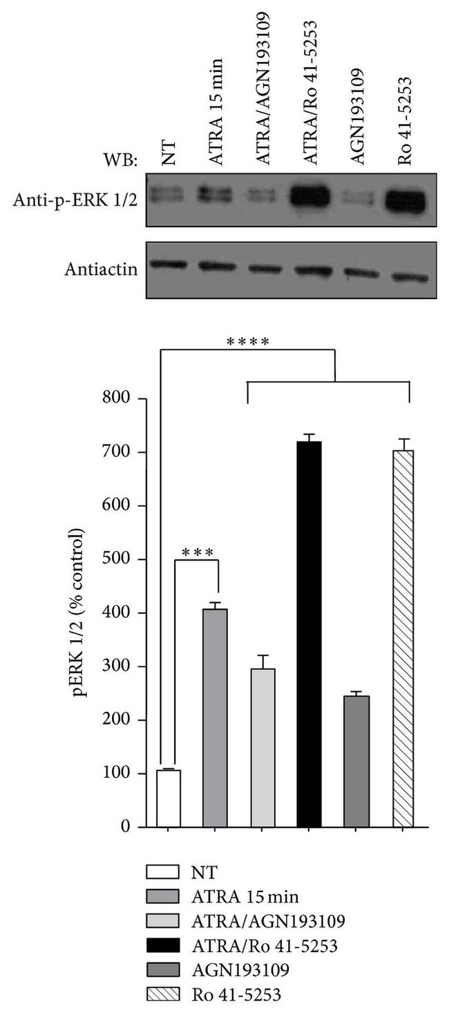 Phospho-ERK1/ERK2 (Thr185, Tyr187) Antibody in Western Blot (WB)