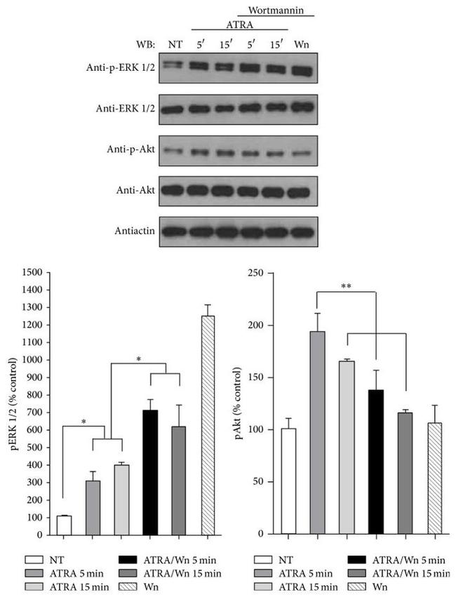 Phospho-ERK1/ERK2 (Thr185, Tyr187) Antibody in Western Blot (WB)