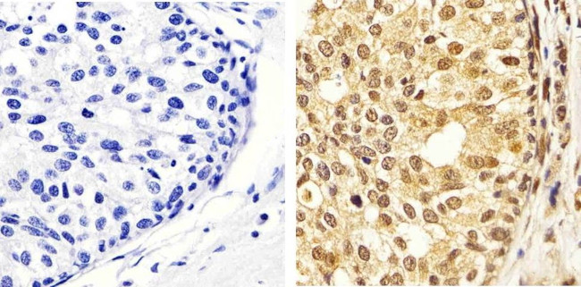 Phospho-ERK1/ERK2 (Thr185, Tyr187) Antibody in Immunohistochemistry (Paraffin) (IHC (P))