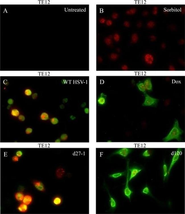 Phospho-JNK1/JNK2 (Thr183, Tyr185) Antibody in Immunocytochemistry (ICC/IF)