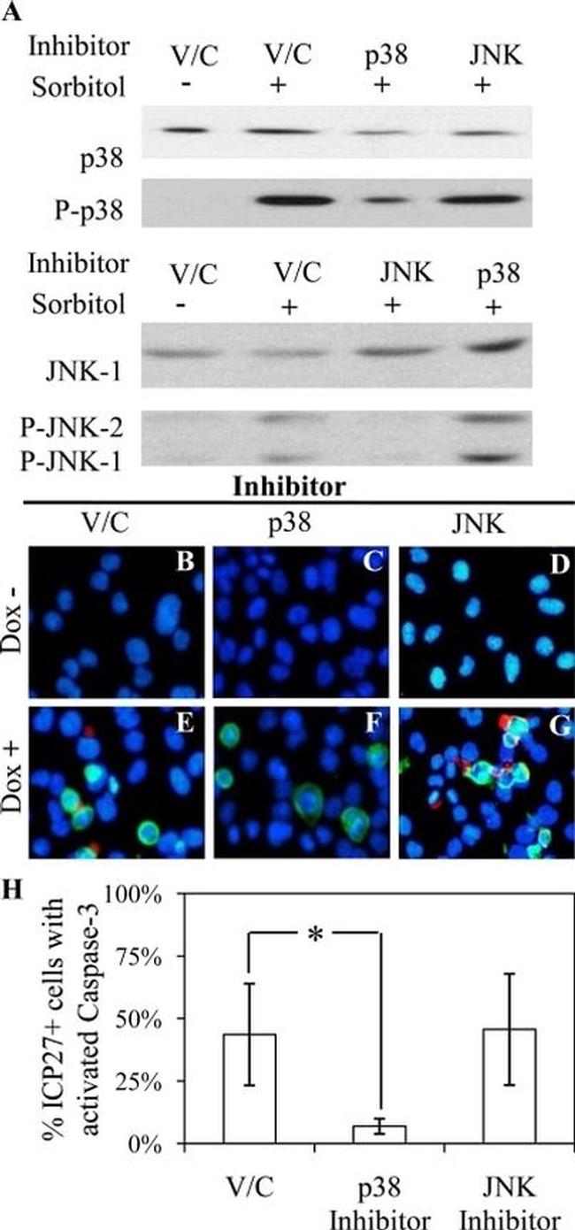 JNK1 Antibody in Western Blot (WB)