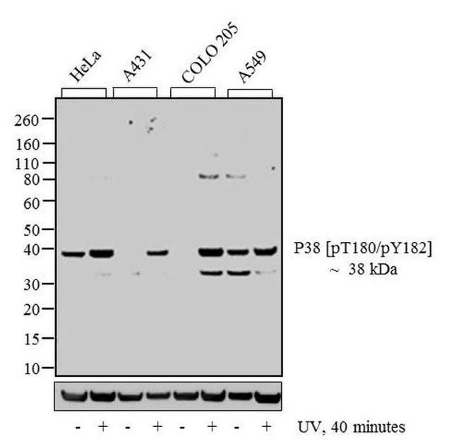 Phospho-p38 MAPK (Thr180, Tyr182) Antibody