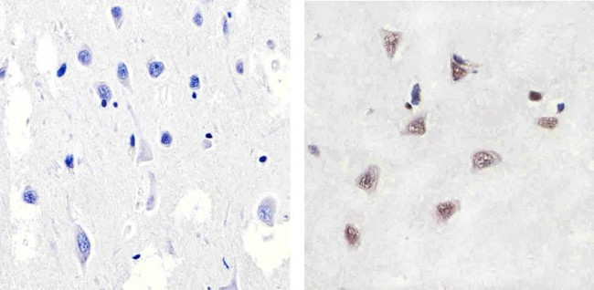 Phospho-p38 MAPK (Thr180, Tyr182) Antibody in Immunohistochemistry (Paraffin) (IHC (P))