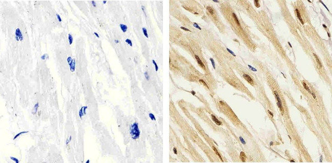 Phospho-p38 MAPK (Thr180, Tyr182) Antibody in Immunohistochemistry (Paraffin) (IHC (P))