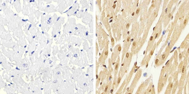 Phospho-p38 MAPK (Thr180, Tyr182) Antibody in Immunohistochemistry (Paraffin) (IHC (P))