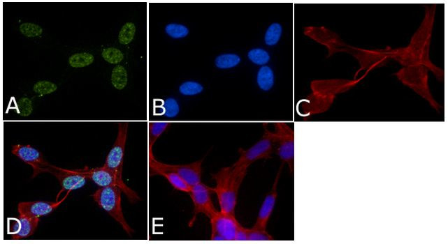 Phospho-p38 MAPK (Thr180, Tyr182) Antibody in Immunocytochemistry (ICC/IF)