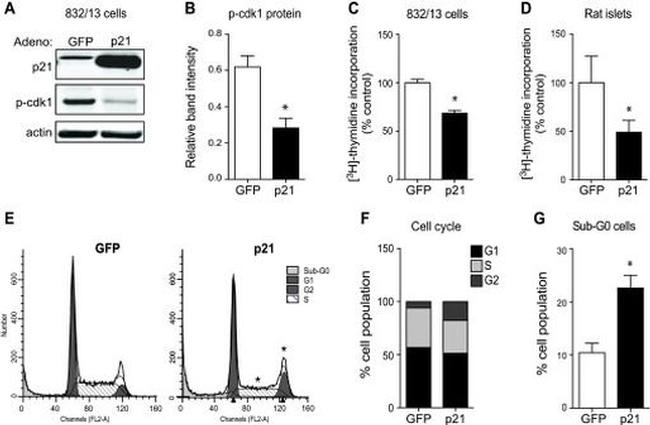 Phospho-CDK1 (Thr14, Tyr15) Antibody in Western Blot (WB)