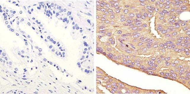 JNK1 Antibody in Immunohistochemistry (Paraffin) (IHC (P))