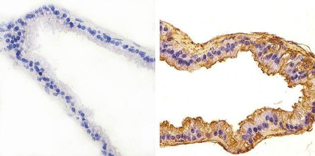 JNK1 Antibody in Immunohistochemistry (Paraffin) (IHC (P))