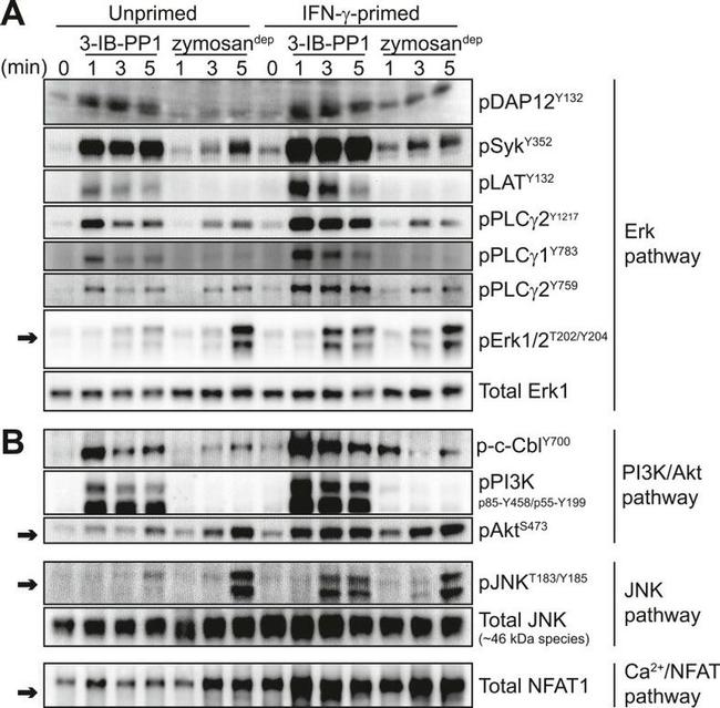 Phospho-PLCG1 (Tyr783) Antibody in Western Blot (WB)