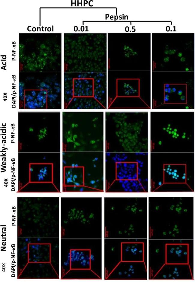 Phospho-NFkB p65 (Ser529) Antibody in Immunocytochemistry (ICC/IF)