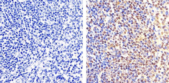 Phospho-NFkB p65 (Ser529) Antibody in Immunohistochemistry (Paraffin) (IHC (P))