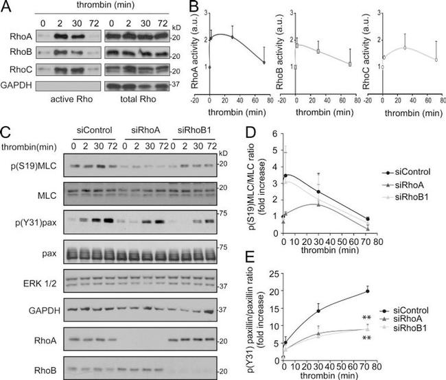 Phospho-Paxillin (Tyr31) Antibody in Western Blot (WB)