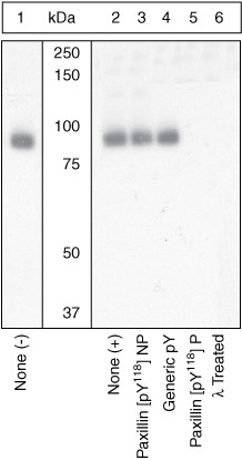 Phospho-Paxillin (Tyr118) Antibody in Western Blot (WB)