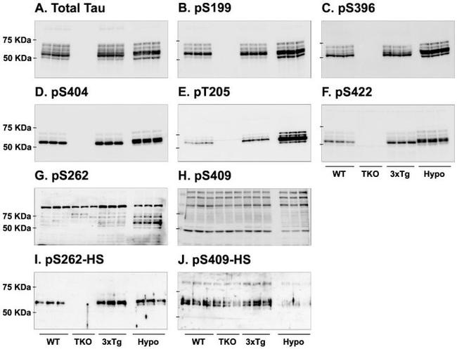 Phospho-Tau (Ser262) Antibody in Western Blot (WB)