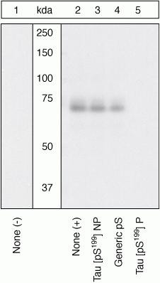 Phospho-Tau (Ser199) Antibody in Western Blot (WB)