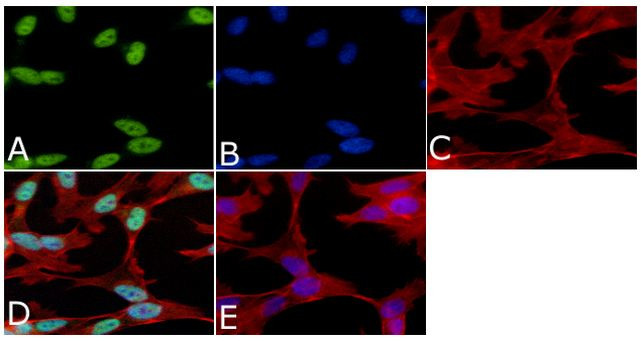 Phospho-Tau (Ser199) Antibody in Immunocytochemistry (ICC/IF)