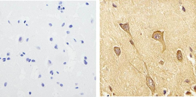 Phospho-Tau (Ser199) Antibody in Immunohistochemistry (Paraffin) (IHC (P))