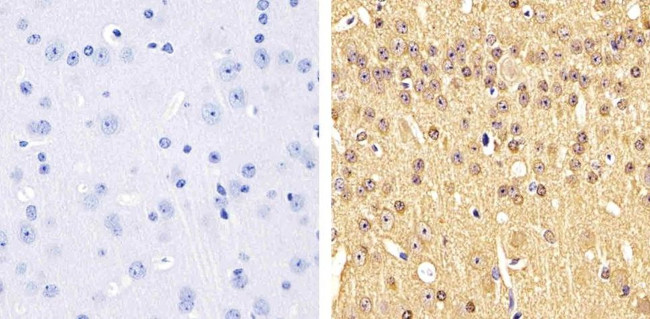 Phospho-Tau (Ser199) Antibody in Immunohistochemistry (Paraffin) (IHC (P))