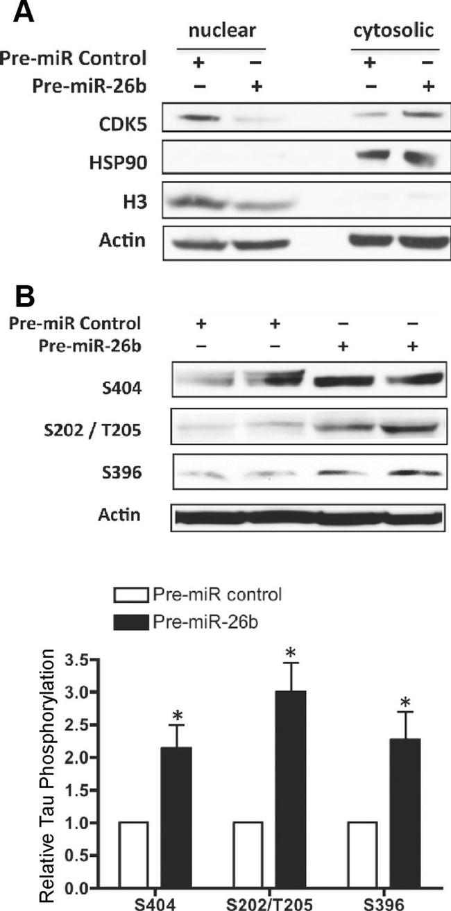 Phospho-Tau (Ser396) Antibody in Western Blot (WB)