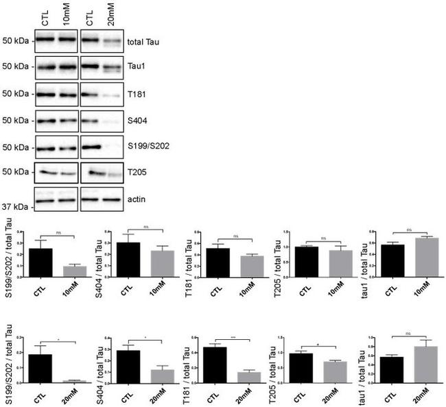 Phospho-Tau (Ser199, Ser202) Antibody in Western Blot (WB)