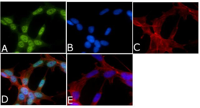 Phospho-Tau (Thr205) Antibody in Immunocytochemistry (ICC/IF)