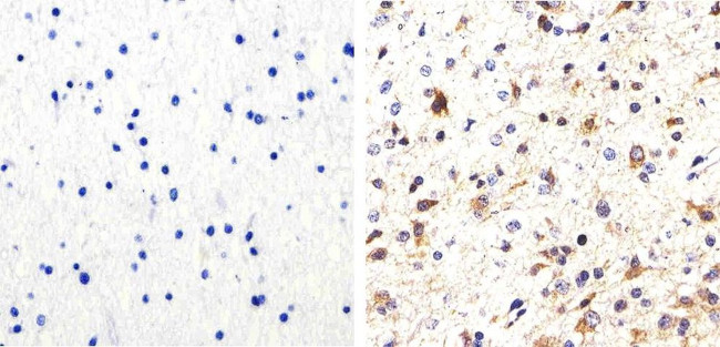 Phospho-Tau (Ser214) Antibody in Immunohistochemistry (Paraffin) (IHC (P))