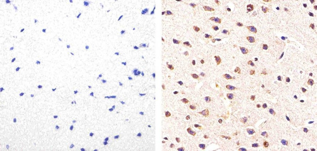 Phospho-Tau (Ser214) Antibody in Immunohistochemistry (Paraffin) (IHC (P))