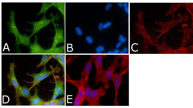 Phospho-Tau (Ser214) Antibody in Immunocytochemistry (ICC/IF)