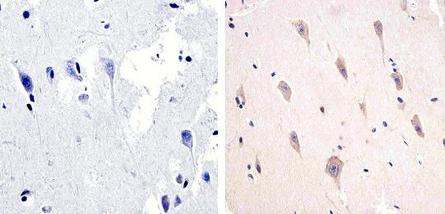 Phospho-Tau (Thr217) Antibody in Immunohistochemistry (Paraffin) (IHC (P))