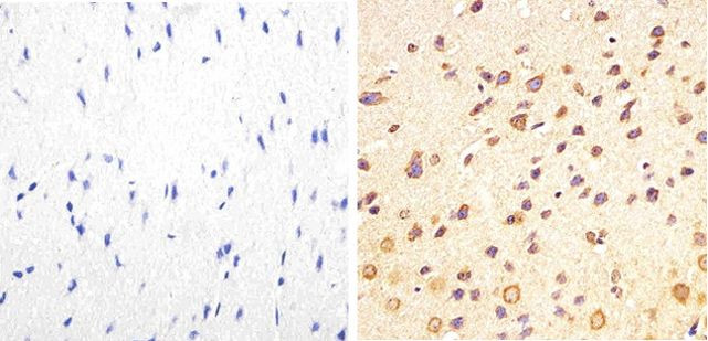 Phospho-Tau (Thr217) Antibody in Immunohistochemistry (Paraffin) (IHC (P))