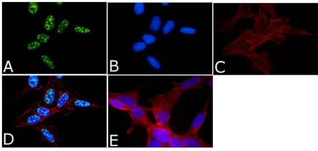 Phospho-Tau (Thr231) Antibody in Immunocytochemistry (ICC/IF)