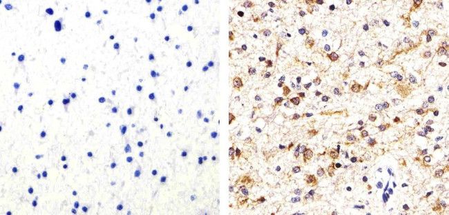 Phospho-Tau (Thr231) Antibody in Immunohistochemistry (Paraffin) (IHC (P))