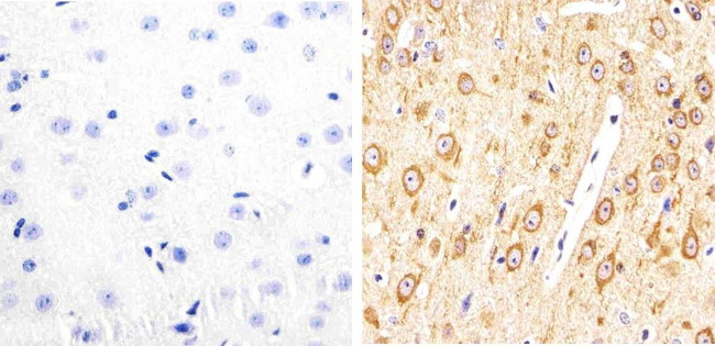 Phospho-Tau (Thr231) Antibody in Immunohistochemistry (Paraffin) (IHC (P))