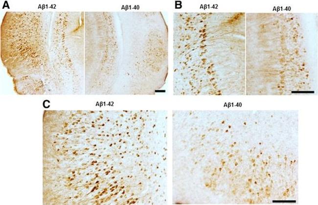 Phospho-Tau (Ser262) Antibody in Immunohistochemistry (IHC)