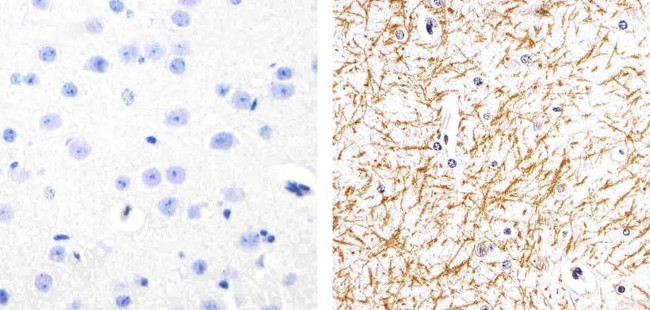 Phospho-Tau (Ser262) Antibody in Immunohistochemistry (Paraffin) (IHC (P))